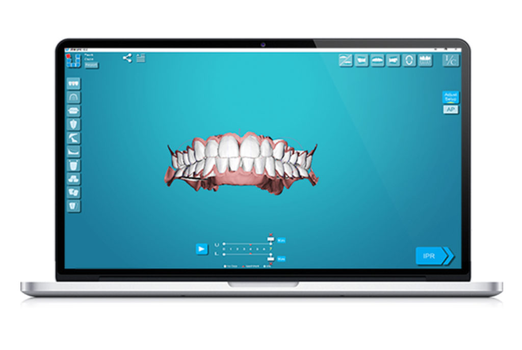 uLab Product